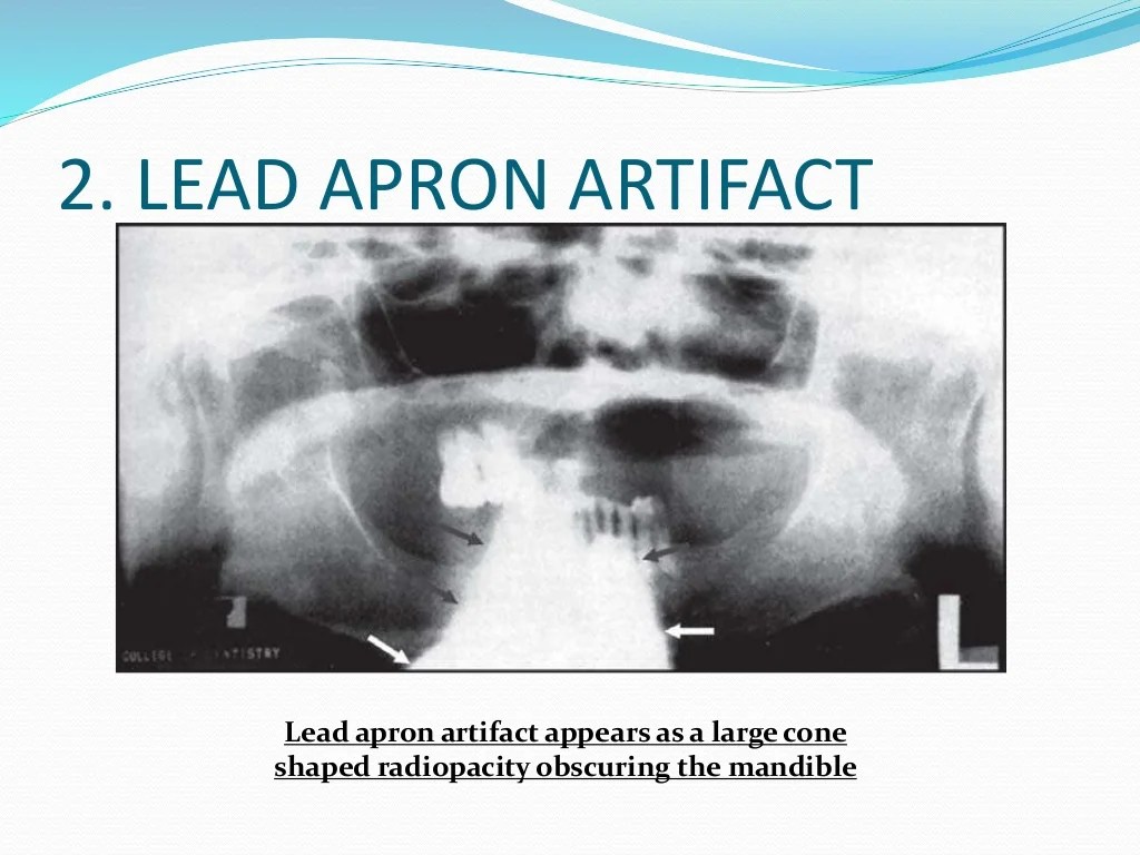 To avoid a lead apron artifact on a panoramic radiograph