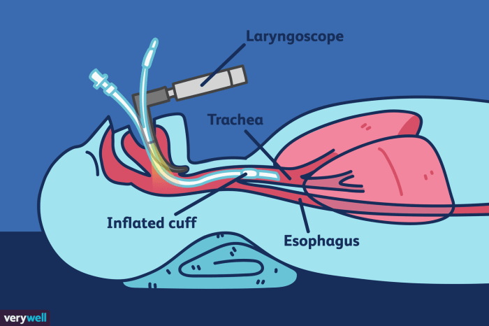 An intubated trauma patient is being transferred